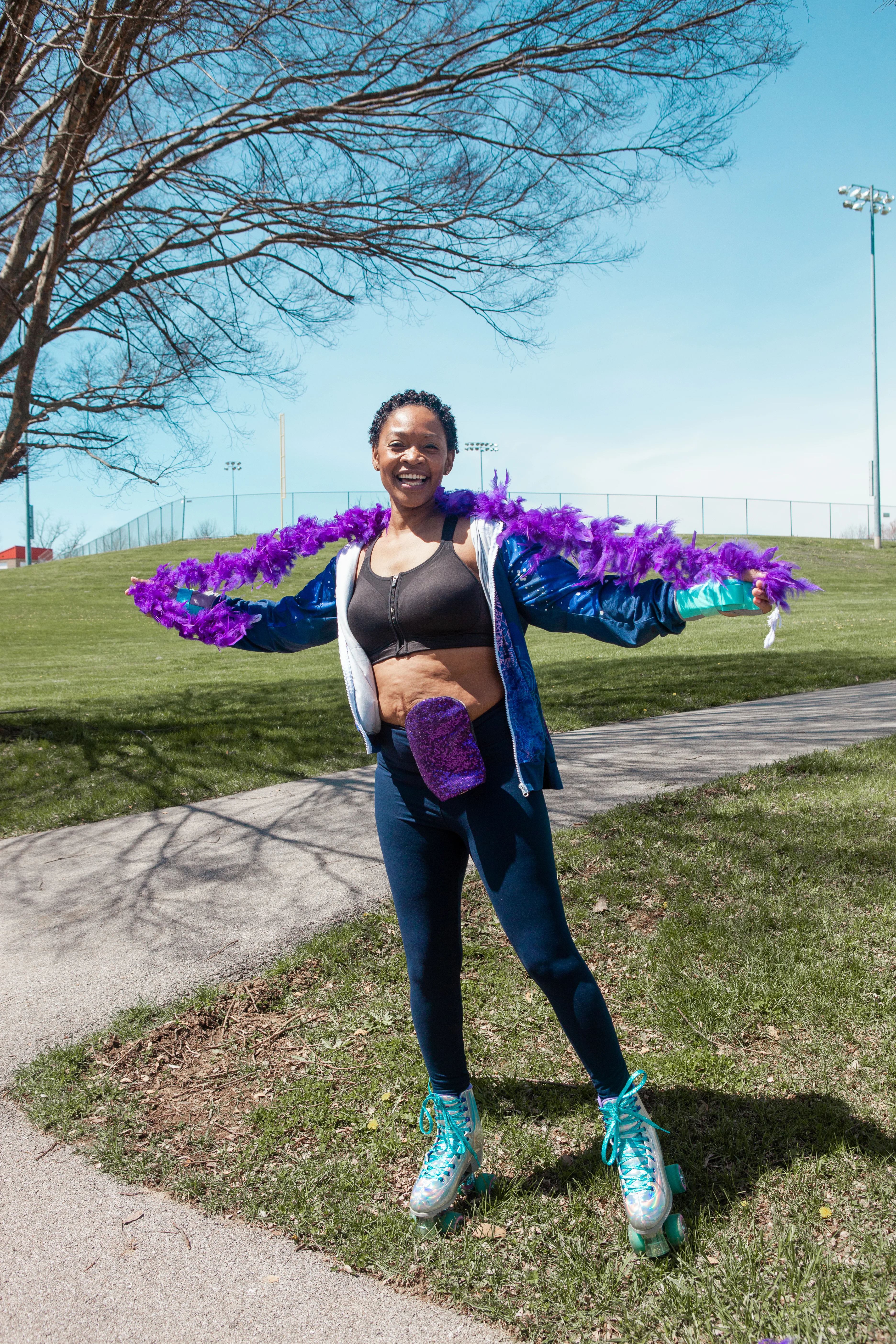 a woman with an ostomy pouch and a feather boa